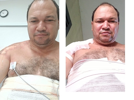CHURRASQUEIRA: Empresário pula em piscina e sobrevive