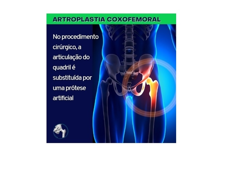 (Imagem ilustrativa)