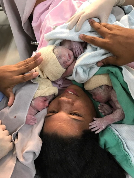MORADORA DE COSMORAMA GANHA TRIGÊMEAS NA SANTA CASA